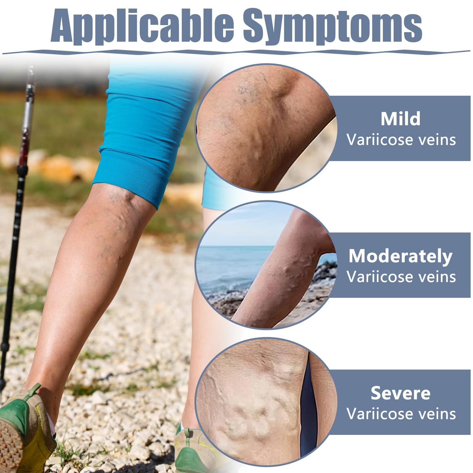 36PCS Varicose Veins Patch – Natural Relief Treatment for Legs, Spider