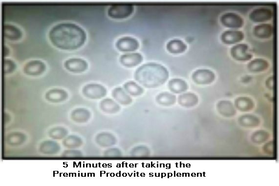 Prodovite Athletic Nutrition(1pk) – Changes the Blood Cells In 5 Minutes see VID