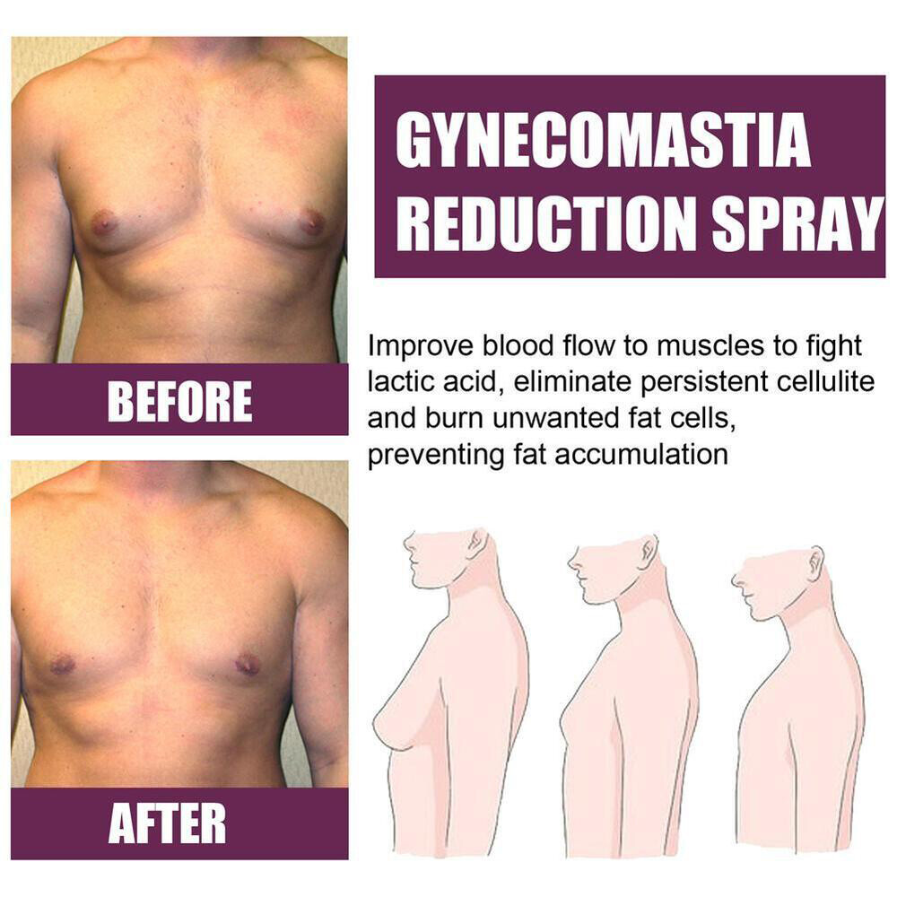 NEW 30ml AUCHEST Gynecomastia Reduction Spray Body Shaping (-50% OFF) 2023 Hot