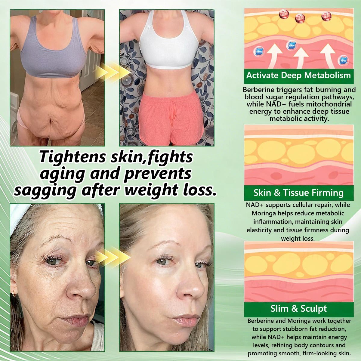 InsLemon Berberine X NAD+ 10-in-1 Nano Microneedle Patches for Weight