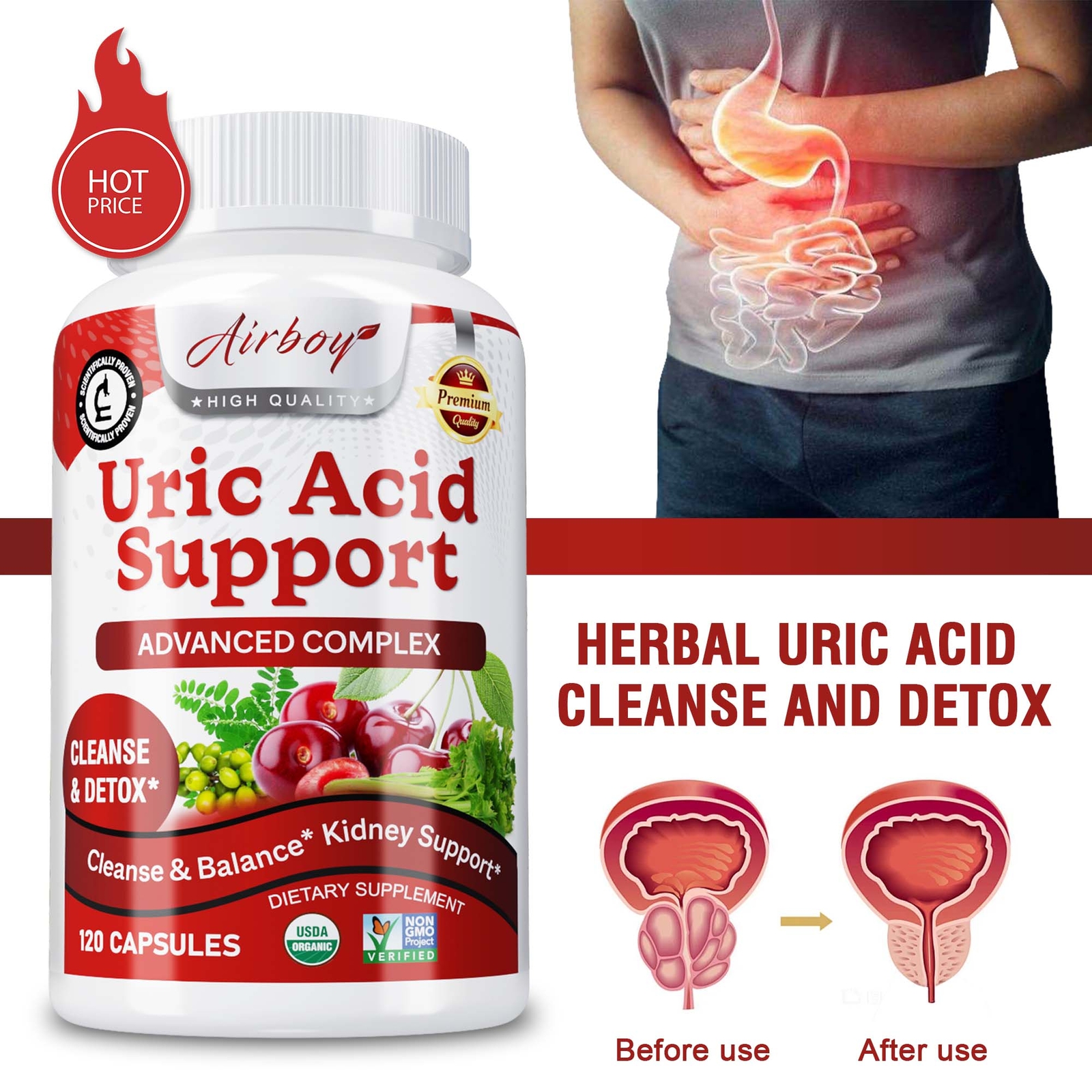 Uric Acid Support – Cleanse & Detox, Balance, Kidney Support – For Gout Relief