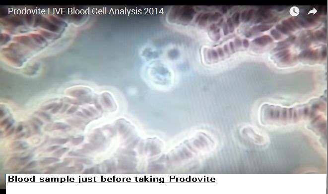 Prodovite Athletic Nutrition(1pk) – Changes the Blood Cells In 5 Minutes see VID