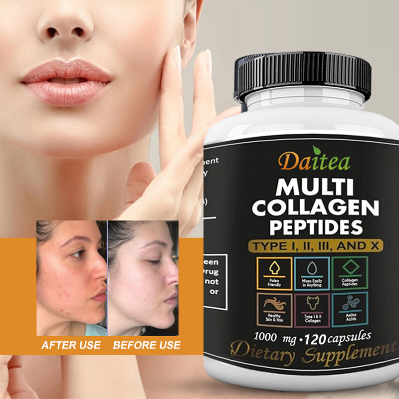 Multi Collagen Peptides 120 Capsules Improve Hair Nails Skin Health Boost Energy