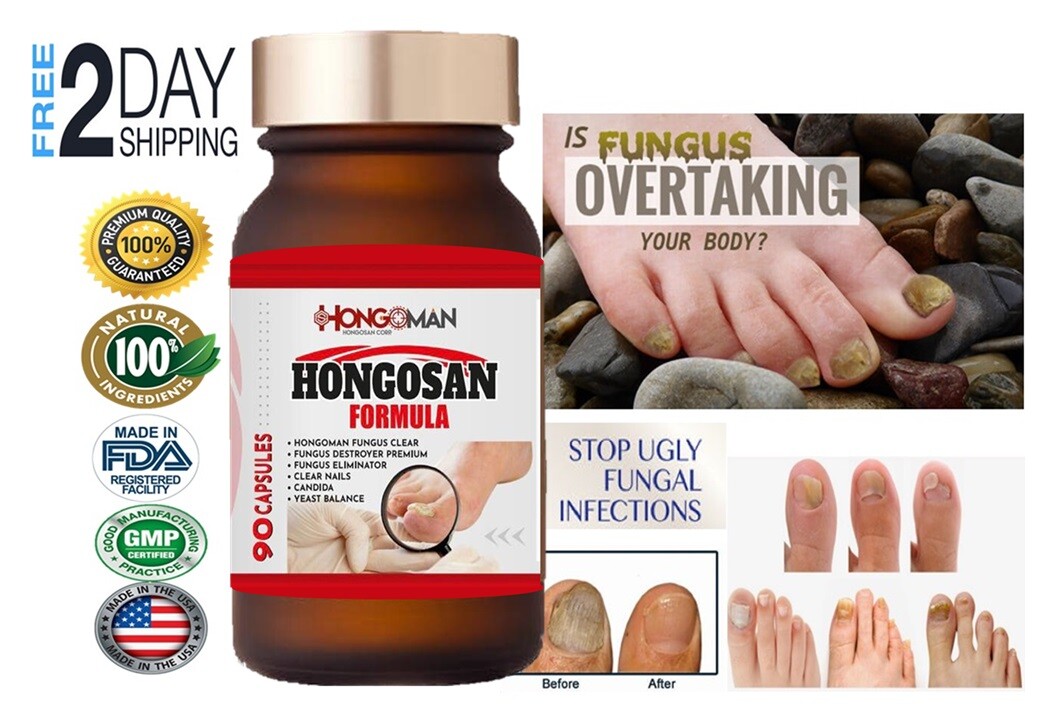 hongosan Support antifungal athletes foot FUNGI 90CAP fungal support